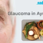 Glaucoma in Ayurveda.