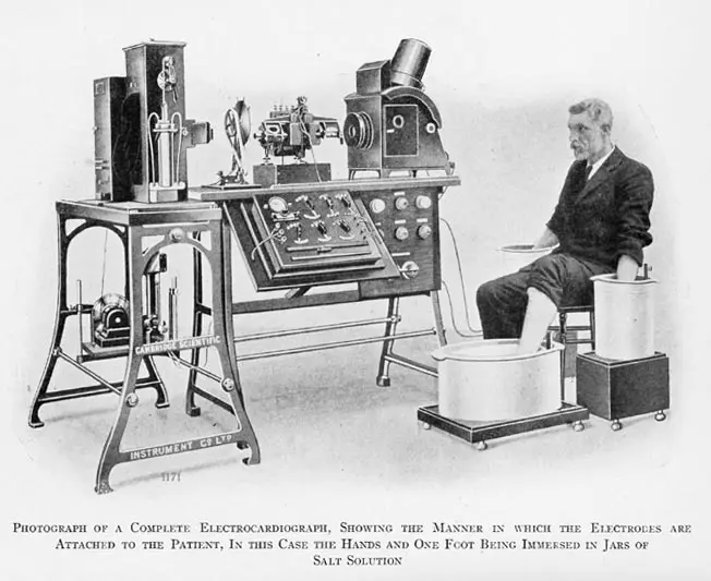 The first ECG machine weighed 600 pounds
